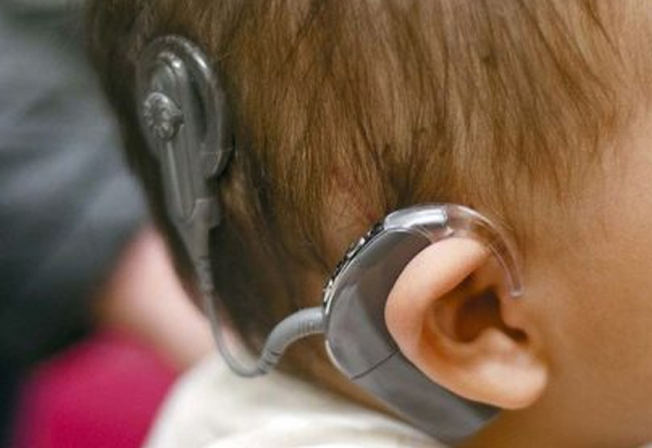 Speech Therapy for Cochlear Implant