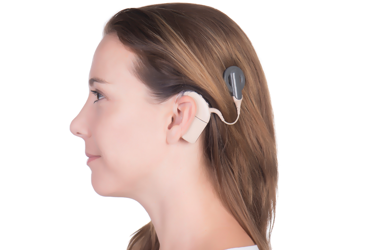 Cochlear Implant